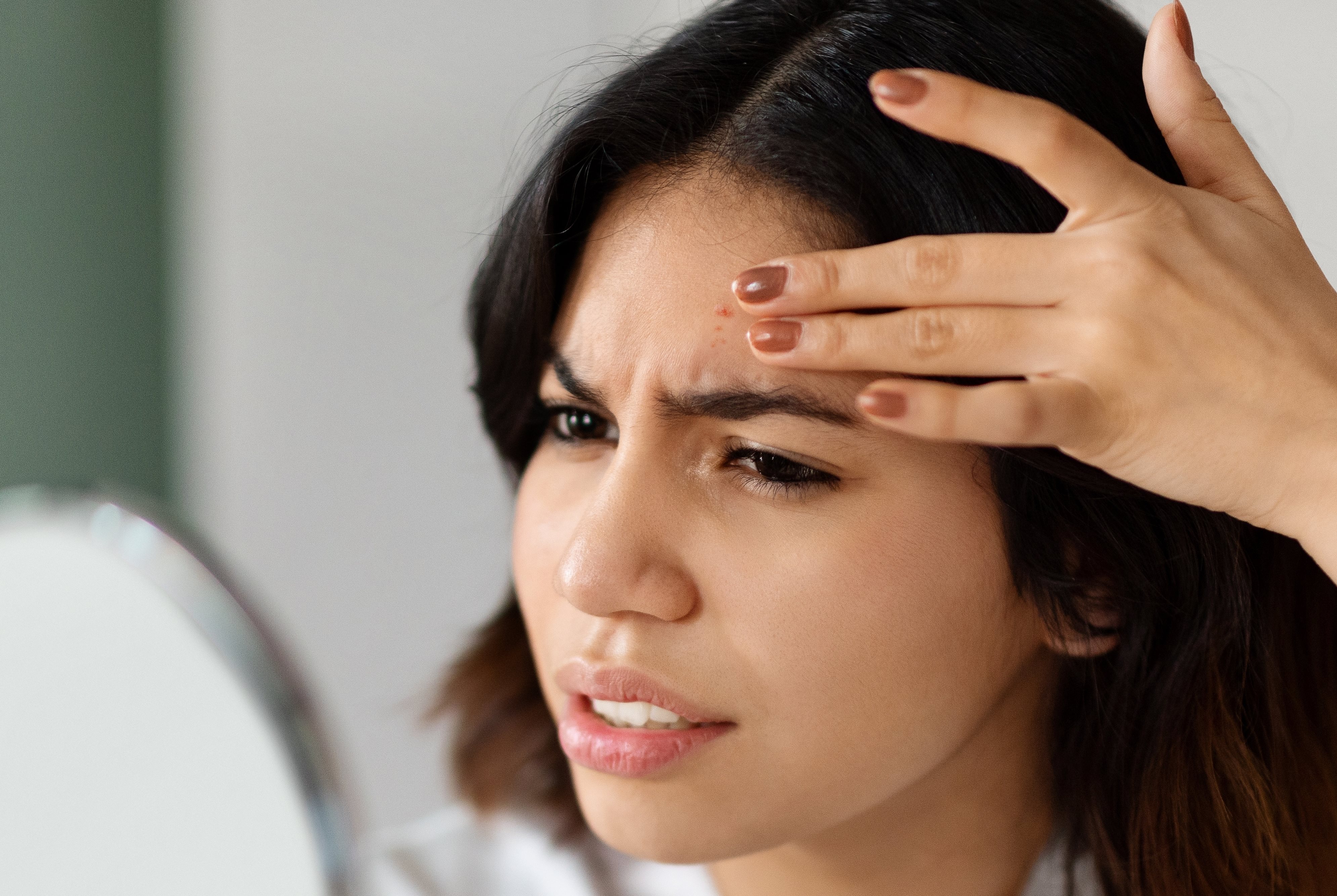 Frau schaut entsetzt in einen Handspiegel und fasst mit der Hand an einen Pickel auf die Stirn.