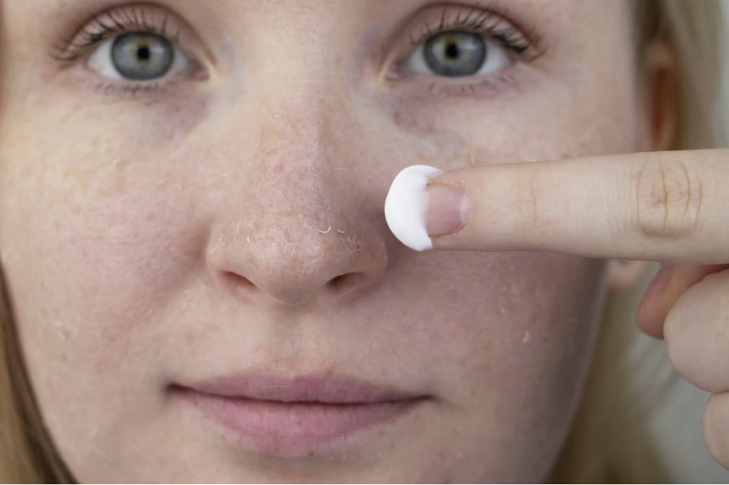 viso donna con pelle secca