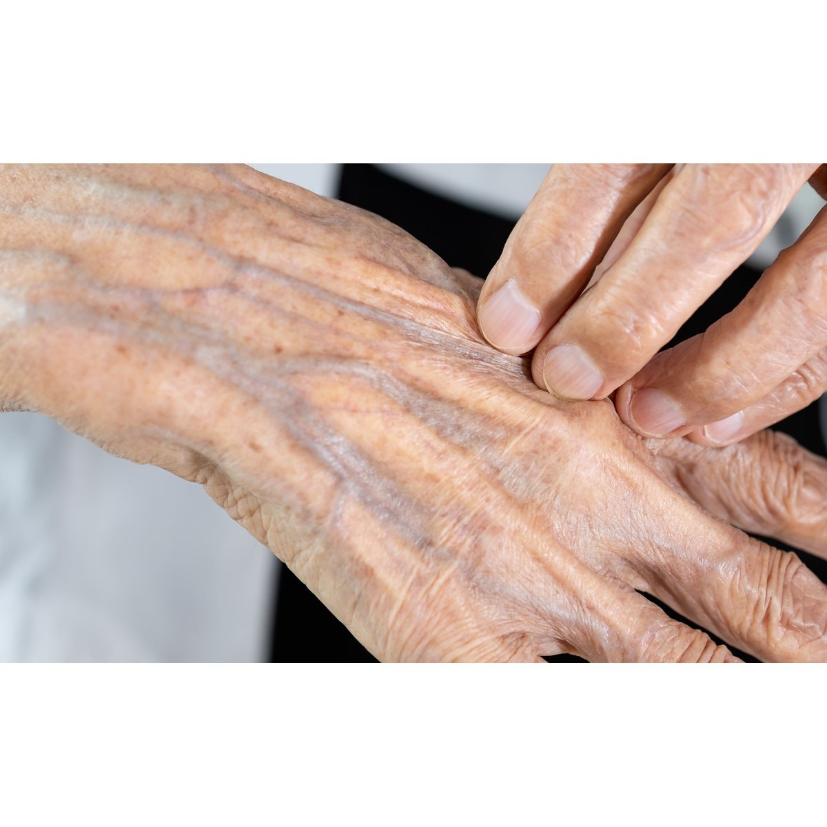 Gros plan sur une main présentant des taches de vieillesse et des rides.