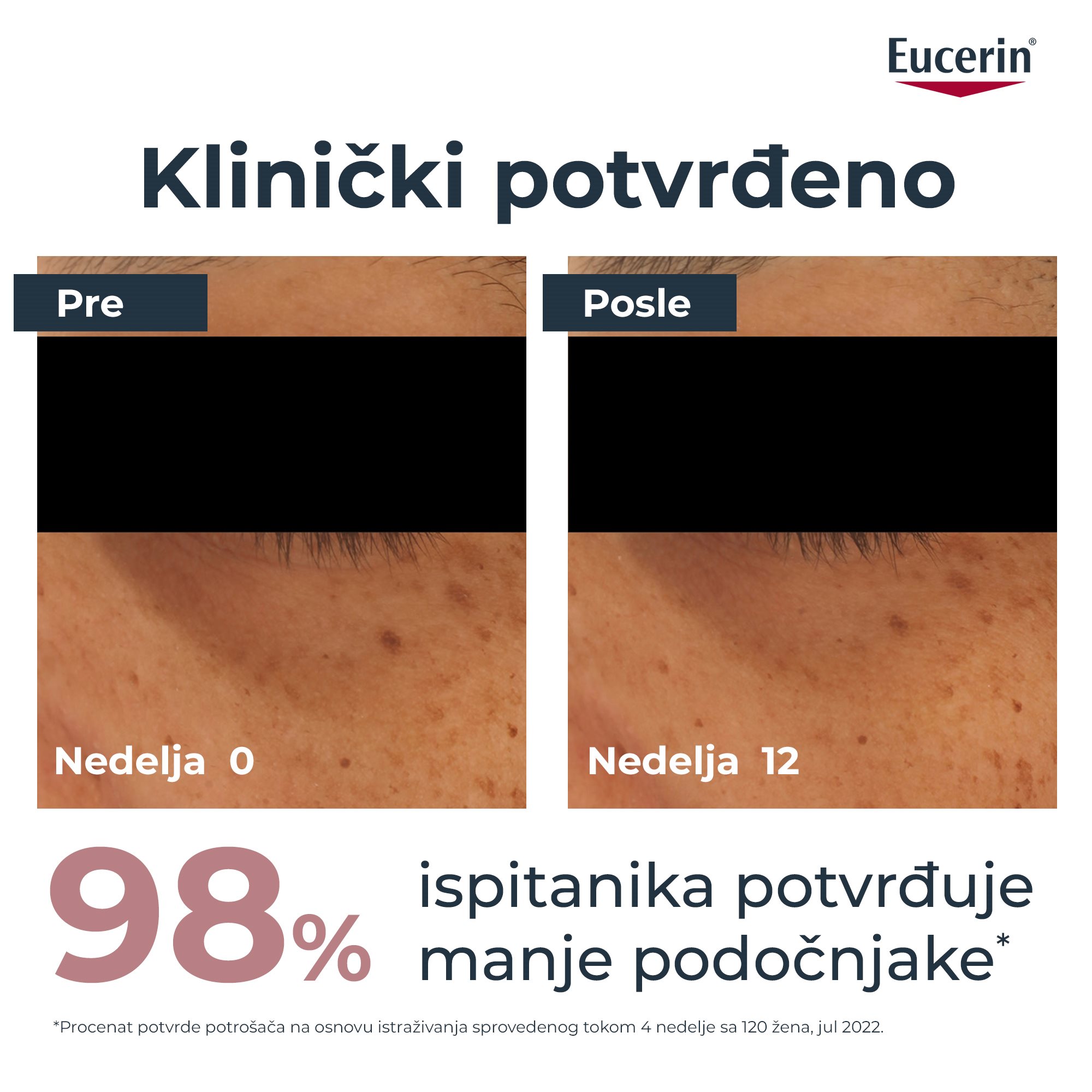 Slika"pre i posle“ koja prikazuje smanjenje pojave podočnjaka nakon 12 nedelja upotrebe. Na slici je takođe prikazano da je 98% korisnika u četvoronedeljnoj studiji samoprocene potvrdilo da su primetili manje izražene podočnjake.