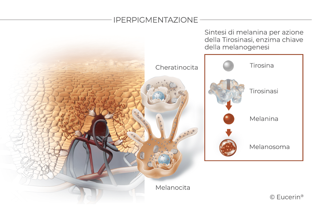 Illustrazione scientifica della sintesi della melanina, che porta alla formazione delle macchie senili.