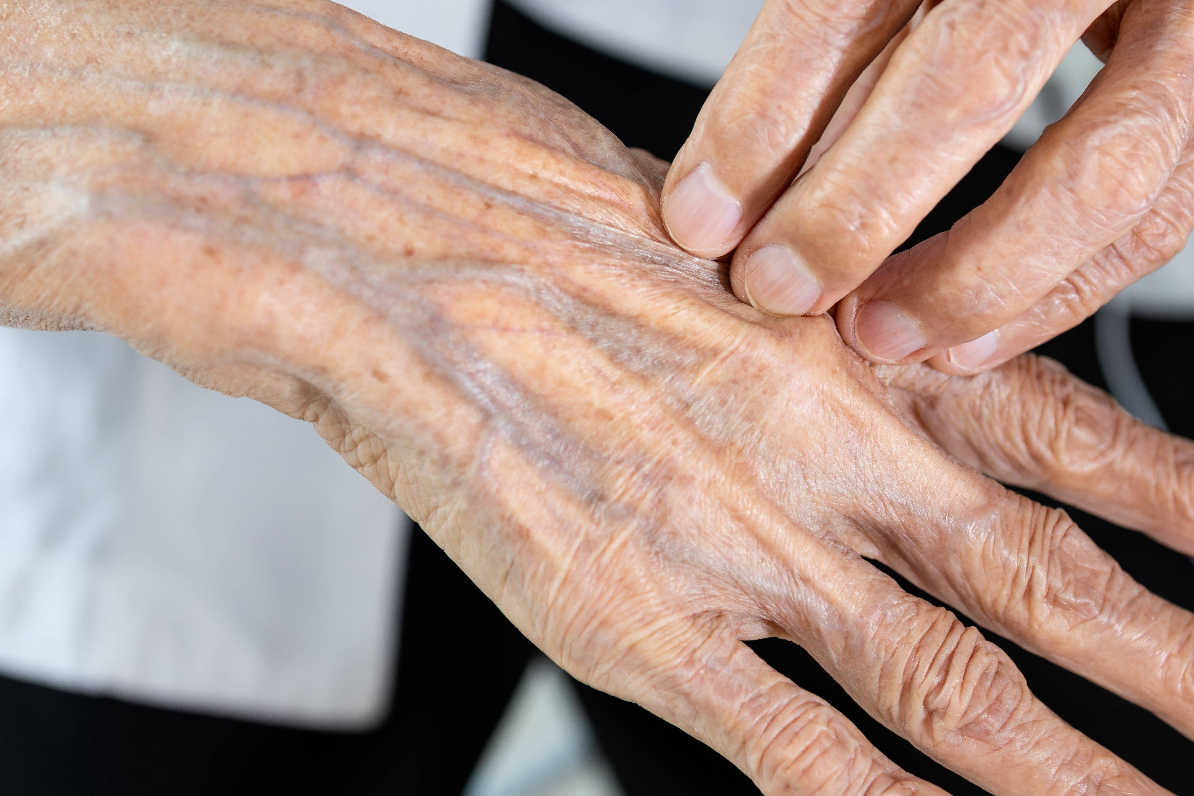 Nahaufnahme einer Hand mit sichtbaren Altersflecken und Falten.