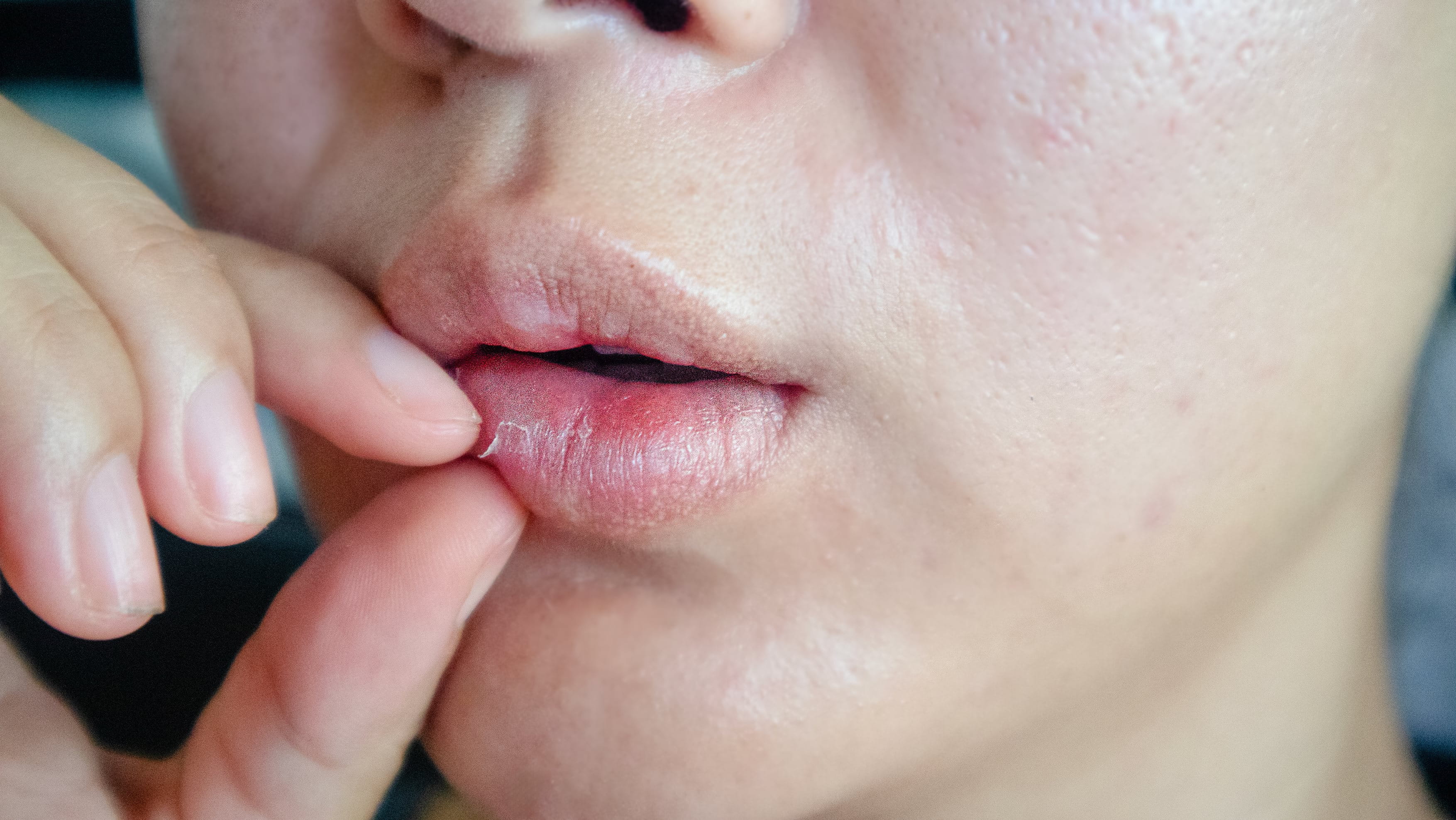 Humidity, Sensitive Skin and Why It Matters