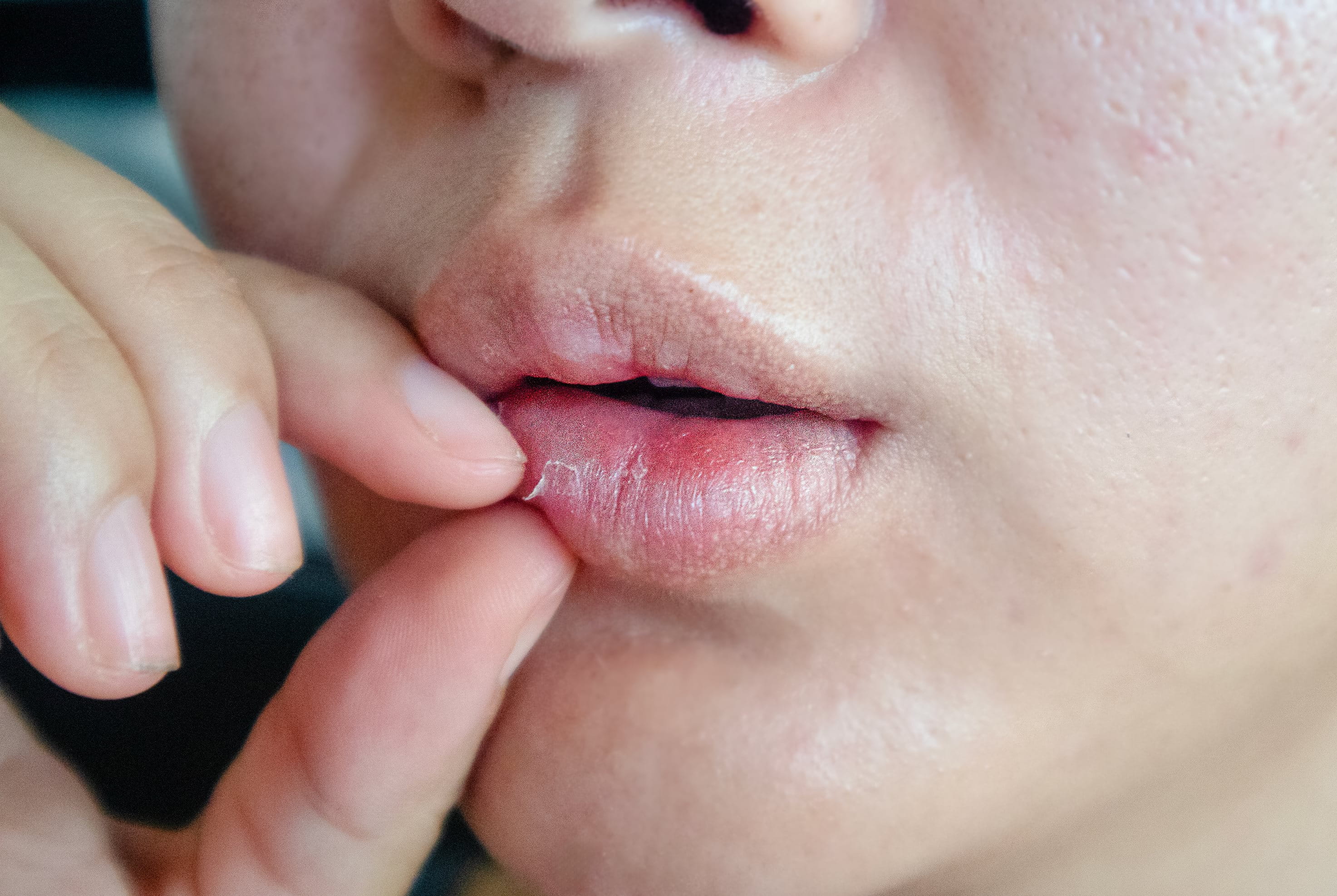 Humidity, Sensitive Skin and Why It Matters