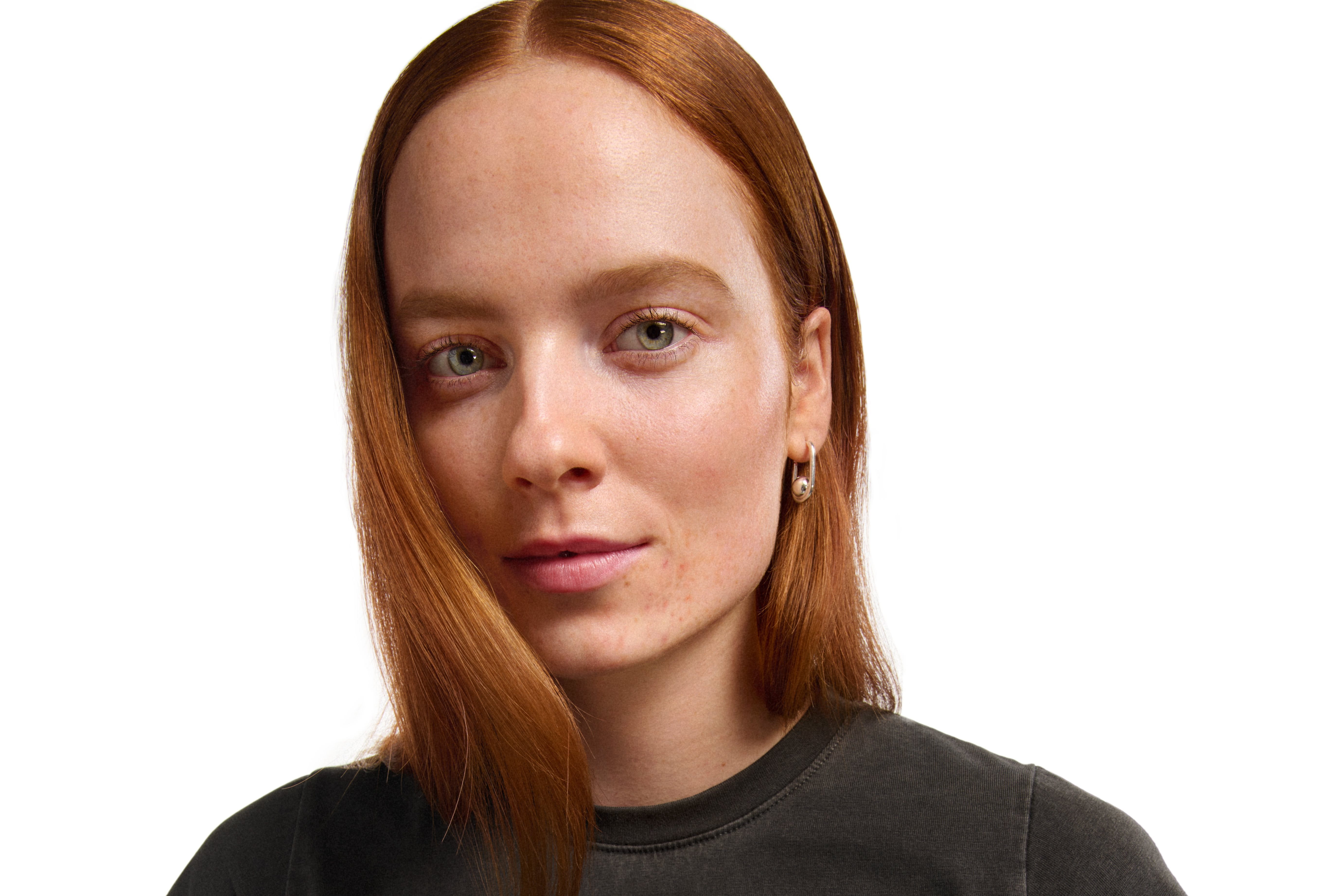 a woman with blackheads and whiteheads