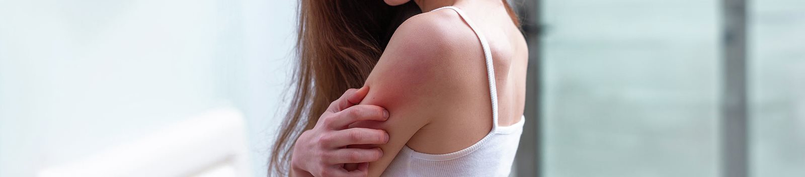 Donna si gratta la parte superiore del braccio arrossata, sintomo visibile di candidosi cutanea