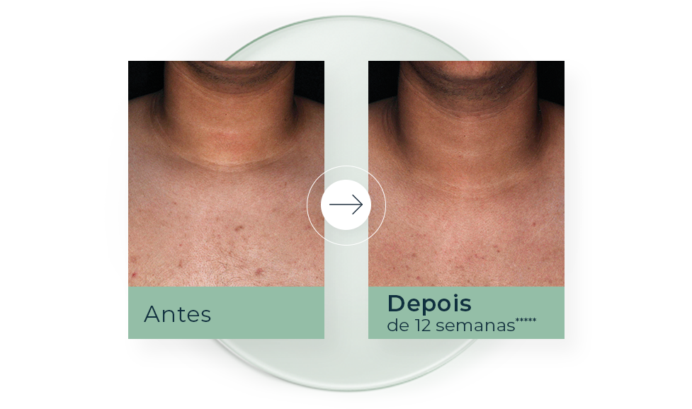 histórias de sucesso