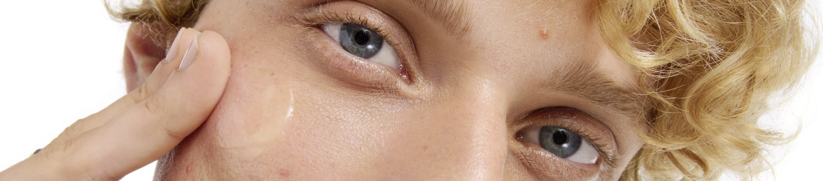 man med finnar i ansiktet