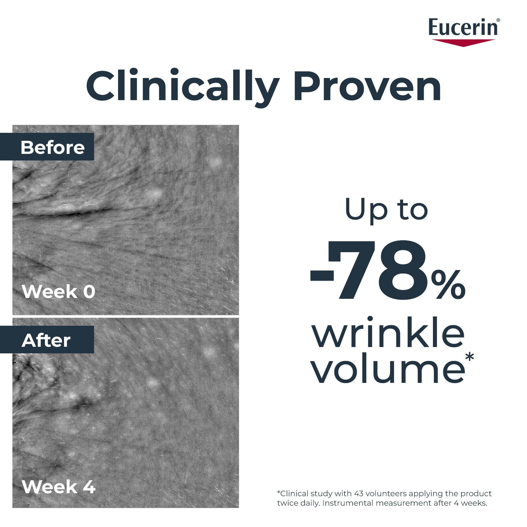 Before and after image showing the results of a clinical study in which Eucerin Hyaluron-Filler + Longevity Epigenetic Serum delivered an up to –78% reduction in wrinkle volume