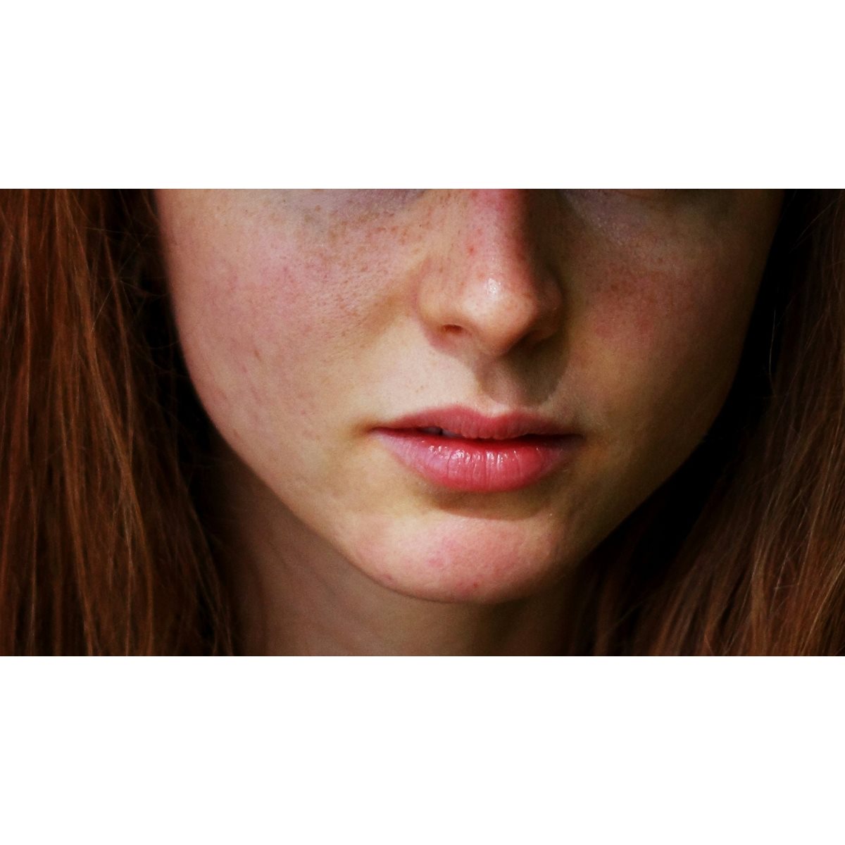 Nahaufname einer jungen Frau mit roten Haaren. Ihr Gesicht zeigt die stark gerötete Wangen, typisch für einen Flush im Gesicht.