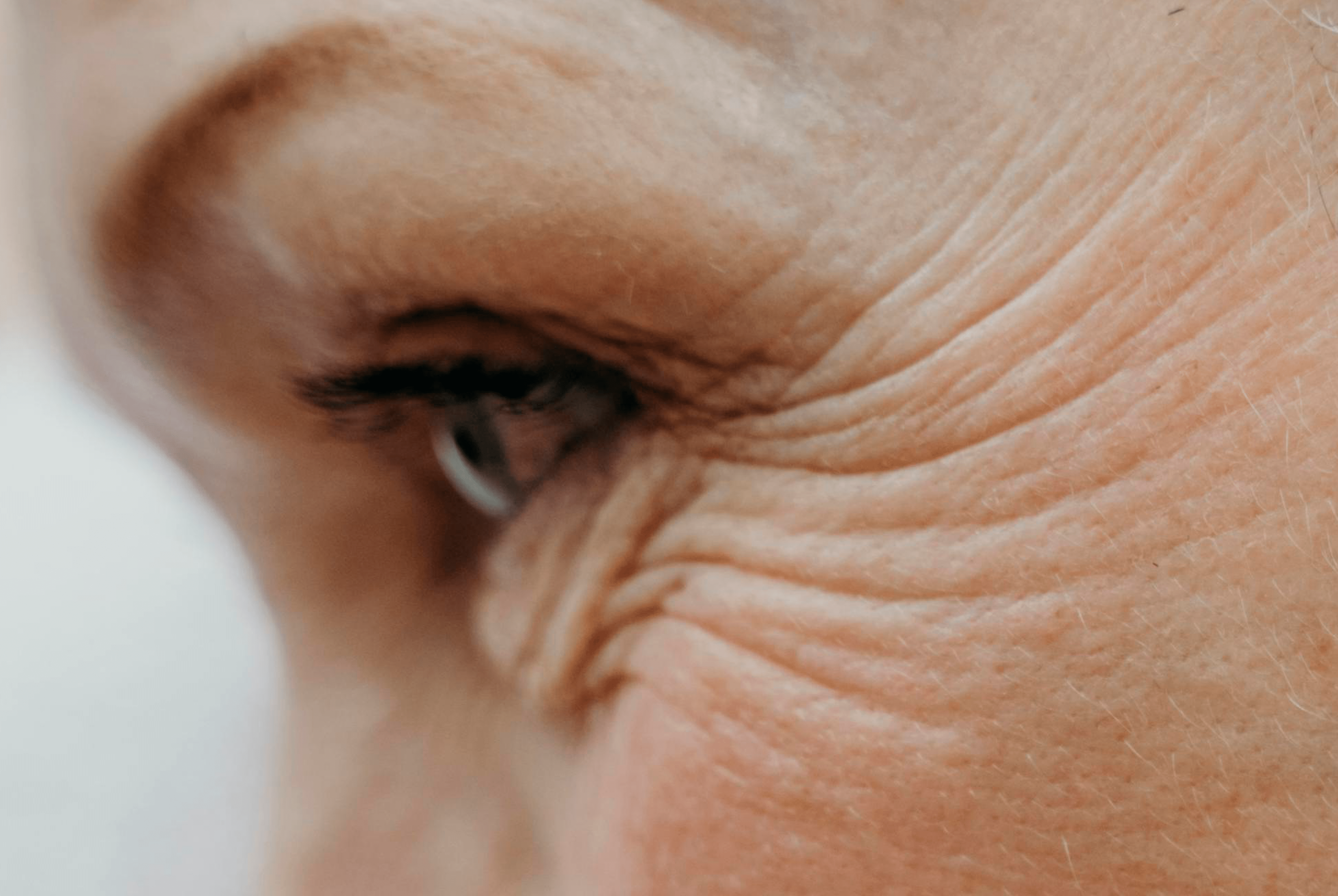 que-es-el-colageno-como-actua-contra-las-arrugas-eucerin