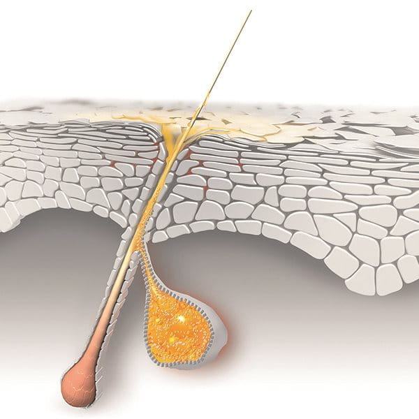 Graph of the sebaceous filaments