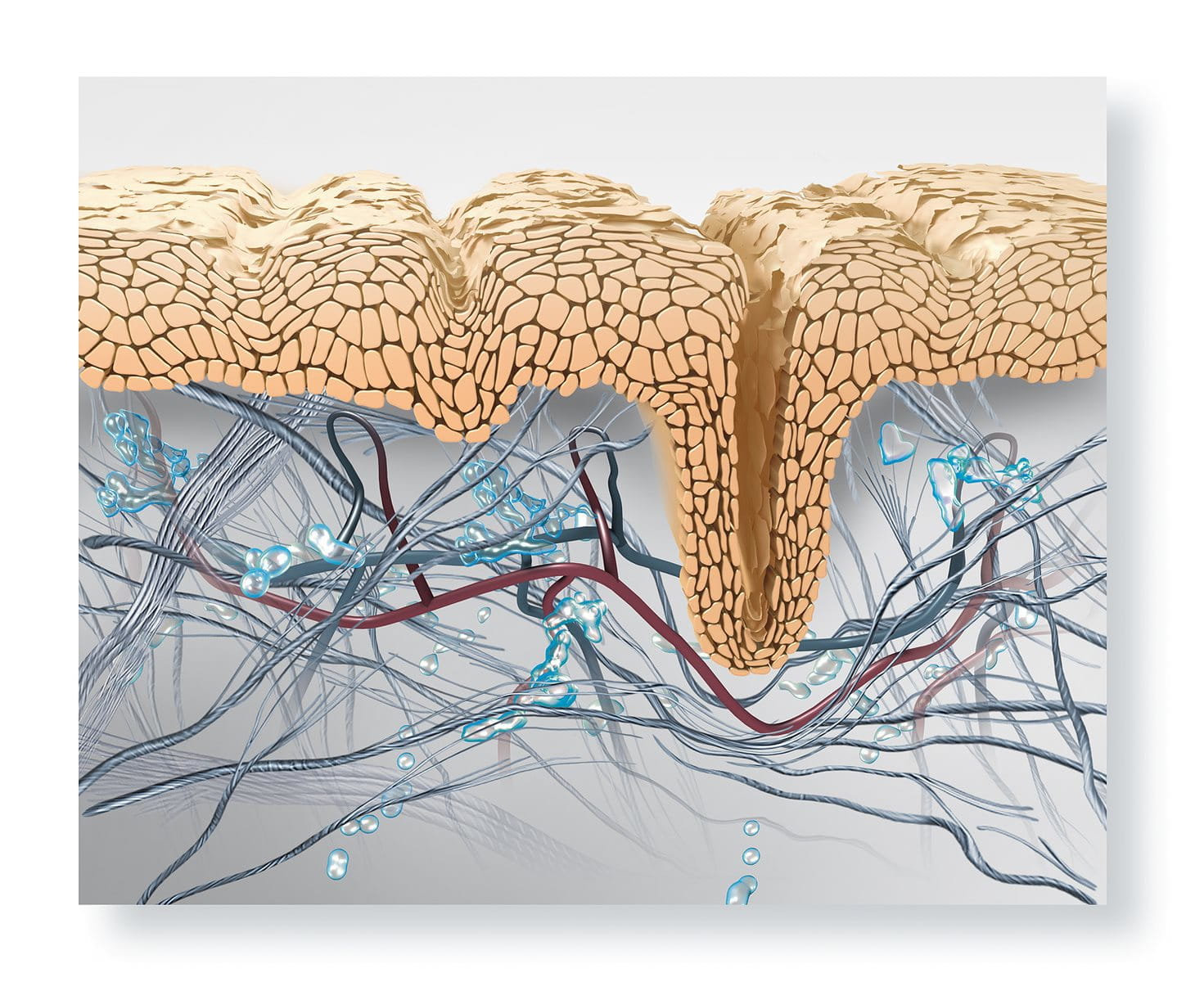 Schematische Darstellung der extrazellulären Matrix und Epidermis von gealterter Haut mit degenerierten Elastin- und Kollagenfasern.