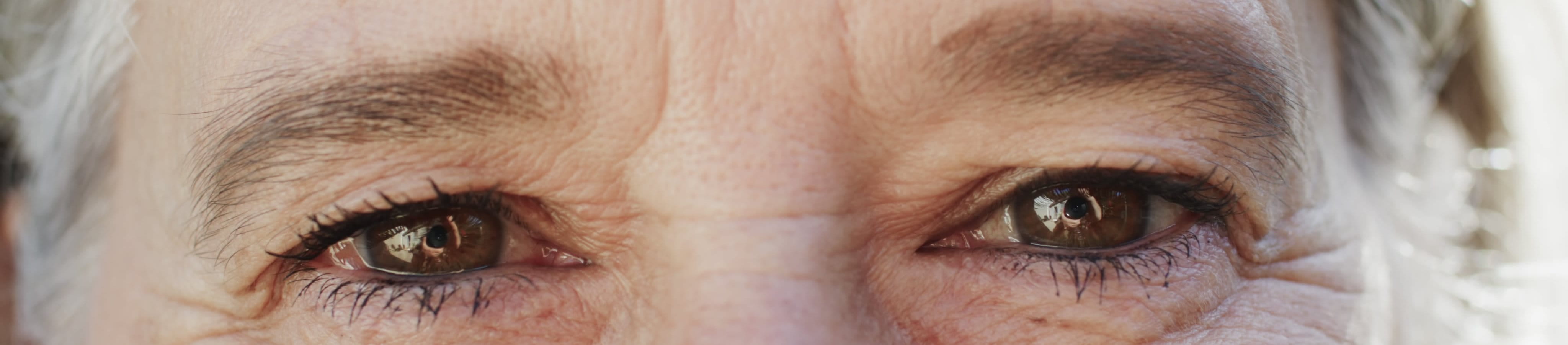 En närbild av en kvinnas bekymmersrynkor