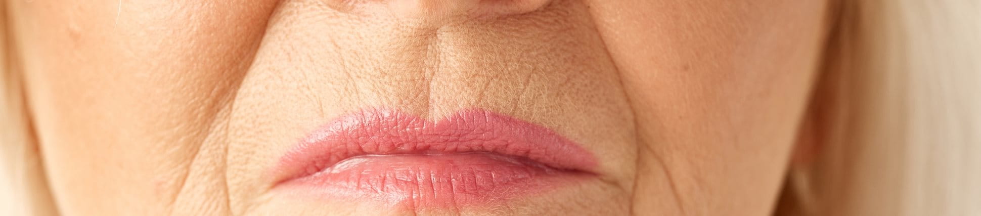 Nahaufnahme einer älteren Frau mit tiefen Nasolabialfalten.