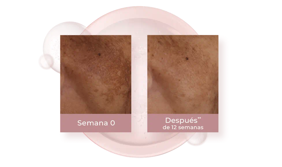 Resultados del uso de Dual Serum en 12 semanas