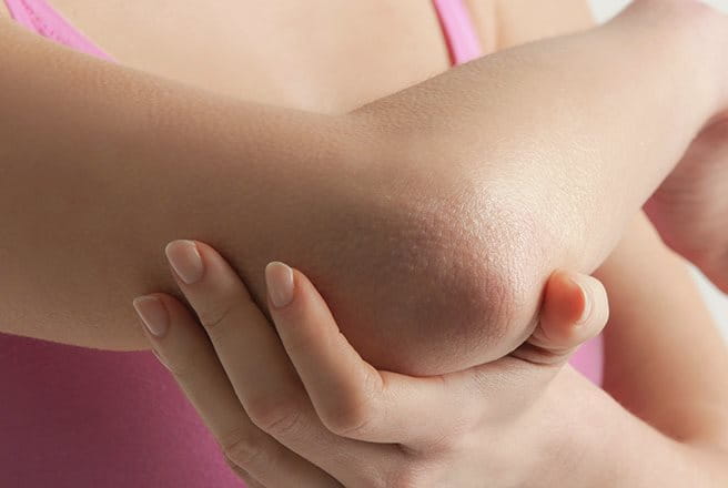 foto di ragazza con gomito secco