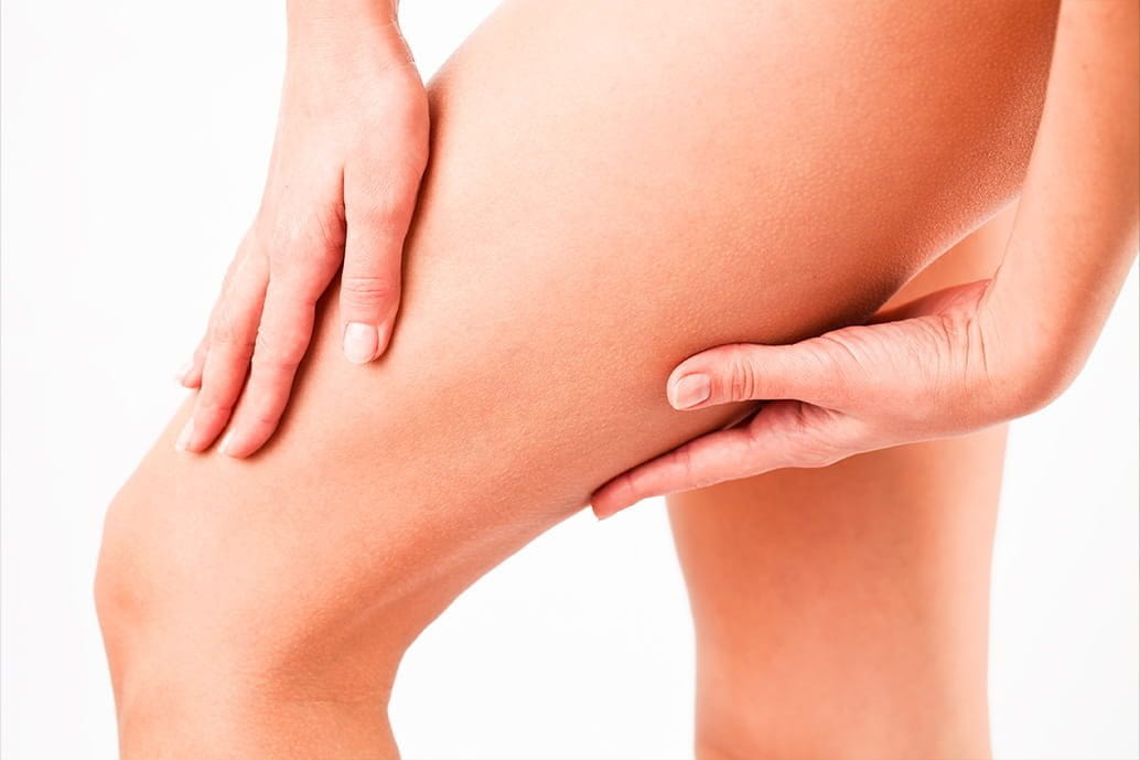 Applicazione di crema riparatrice sulle gambe per lenire e idratare la pelle dopo la depilazione.