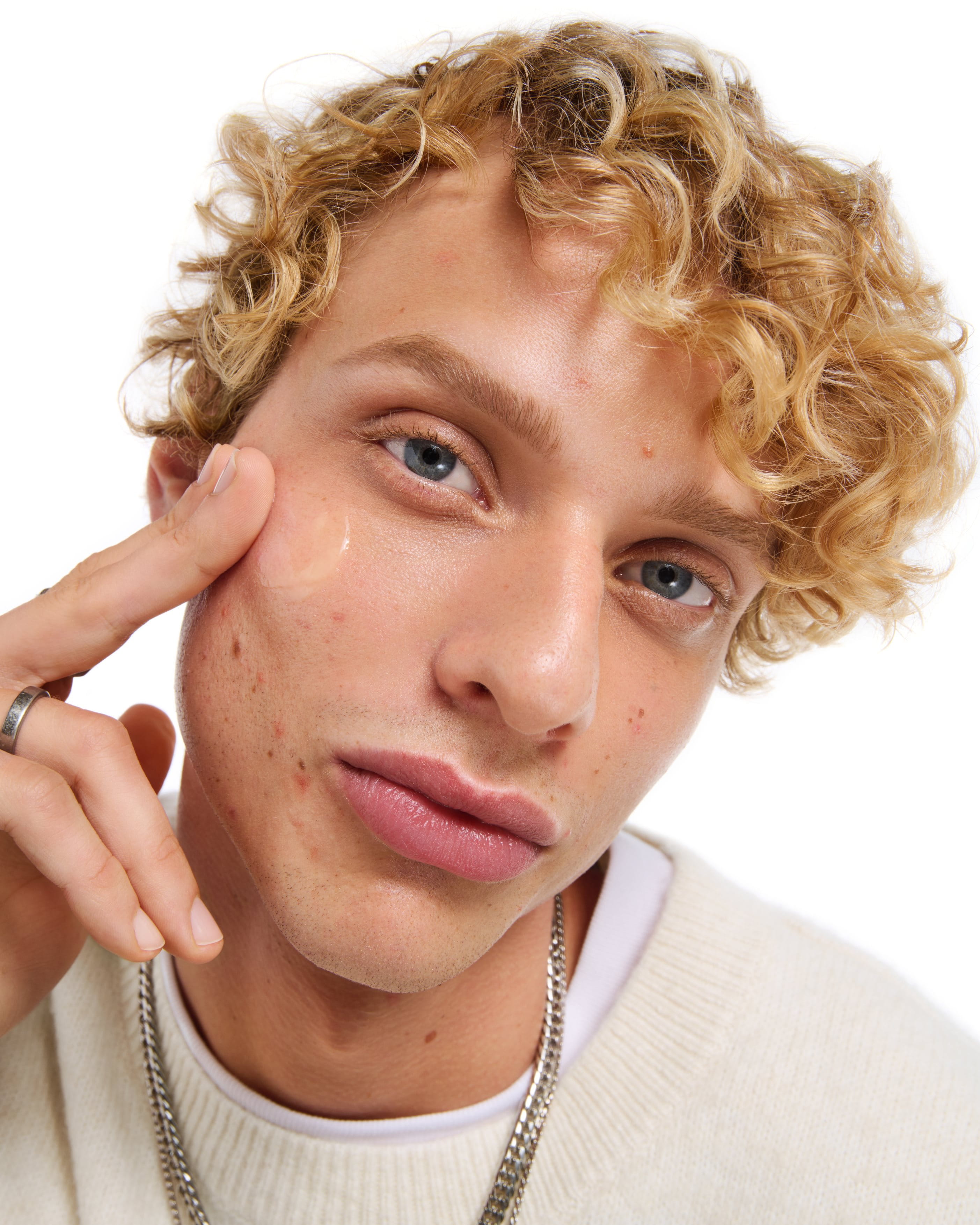 tratamientos-no-medicos-sin-medicacion-para-piel-con-impurezas-propensa-al-acne