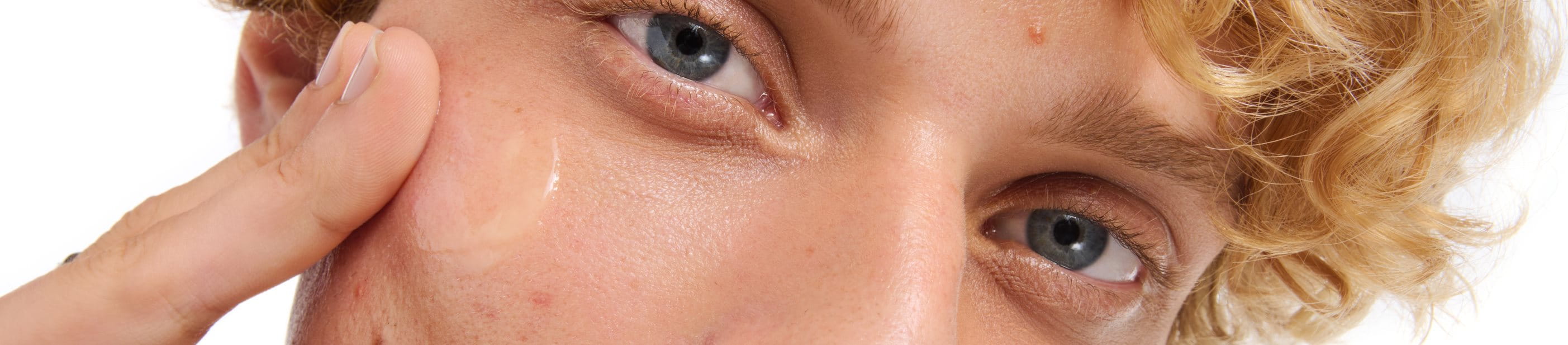 tratamientos-no-medicos-sin-medicacion-para-piel-con-impurezas-propensa-al-acne