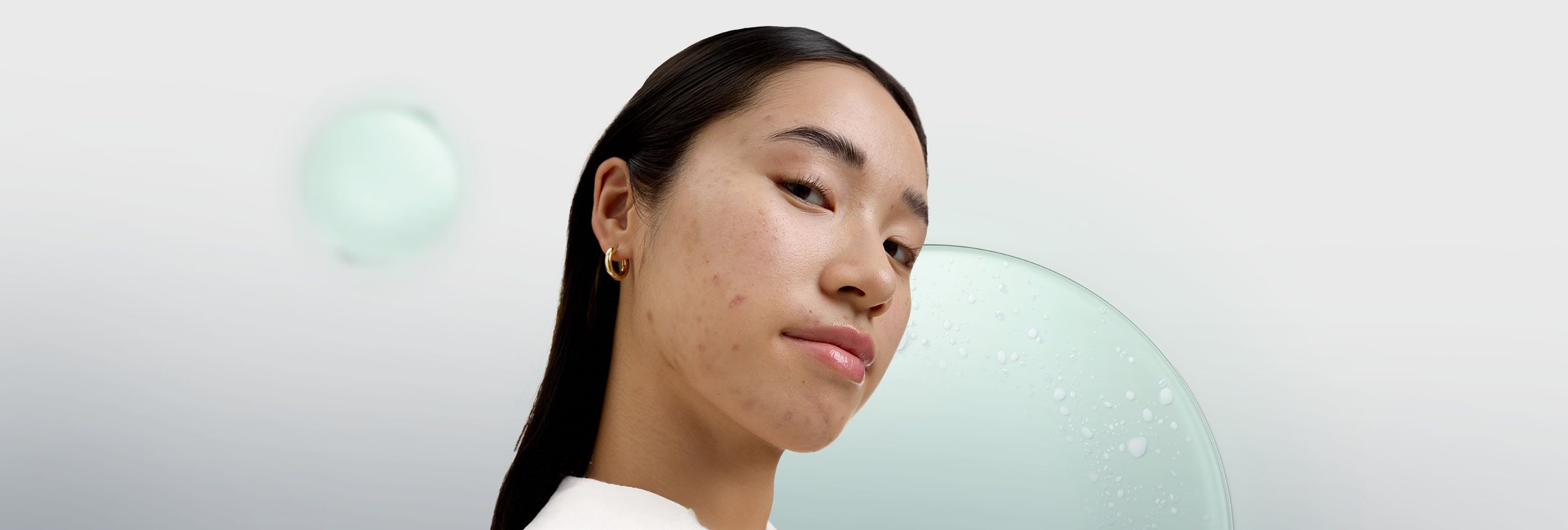 Persona conociendo los tratamientos del acné adolescente