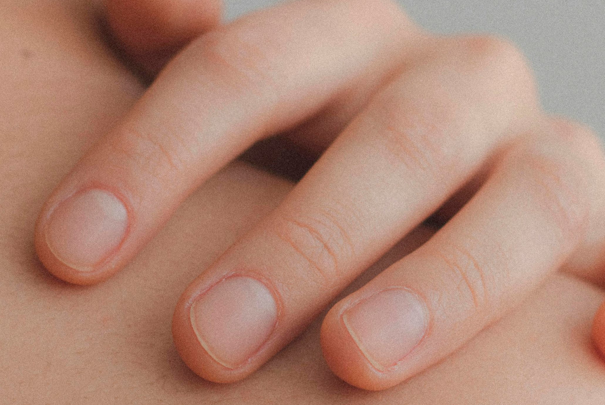 que-es-la-glicerina-como-actua-sobre-piel-seca-eucerin