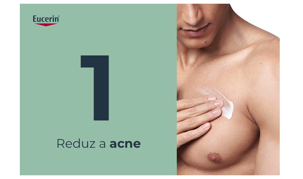 Reduz a acne