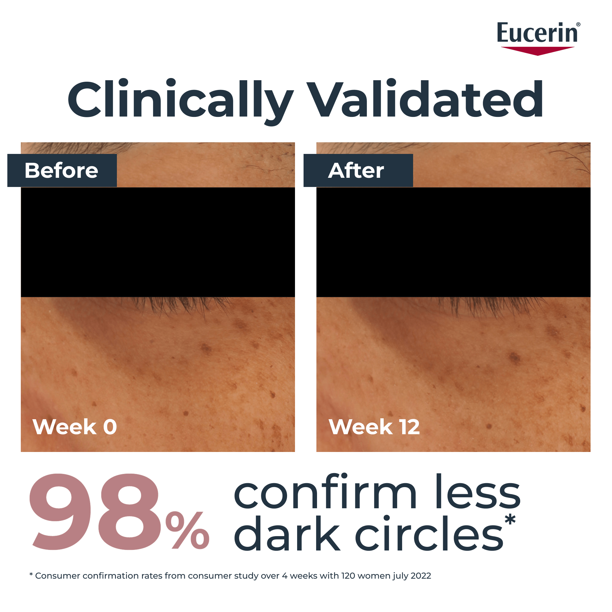 A study result of before and after using Eucerin Anti Pigment Dark Circle Eye Corrector