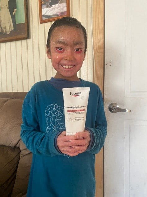 ENCOUNTER / PSORIASIS Project in Germany 