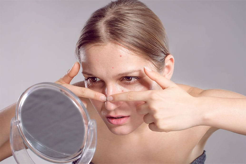 punti neri cosa sono