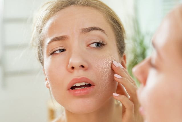 Ragazza osserva la pelle secca e screpolata allo specchio