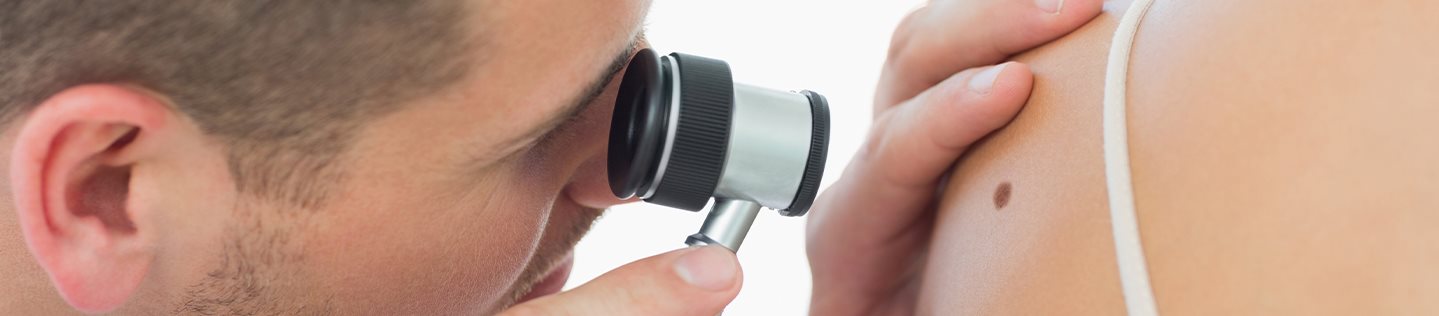 cheratoacantoma: immagine di visita per intervento asportazione cheratoacantoma