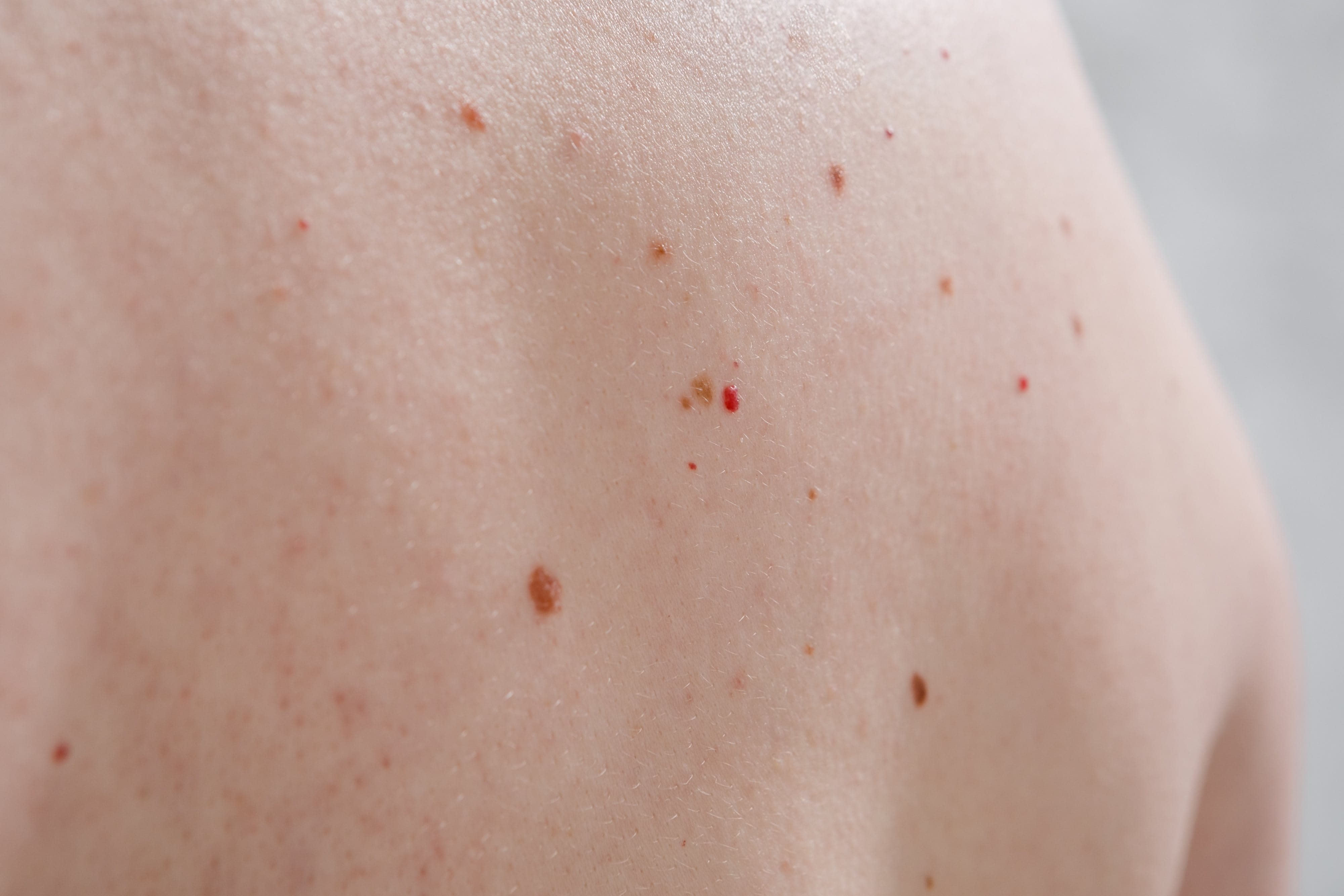 Nahaufnahme eines Rückens mit Rubinflecken