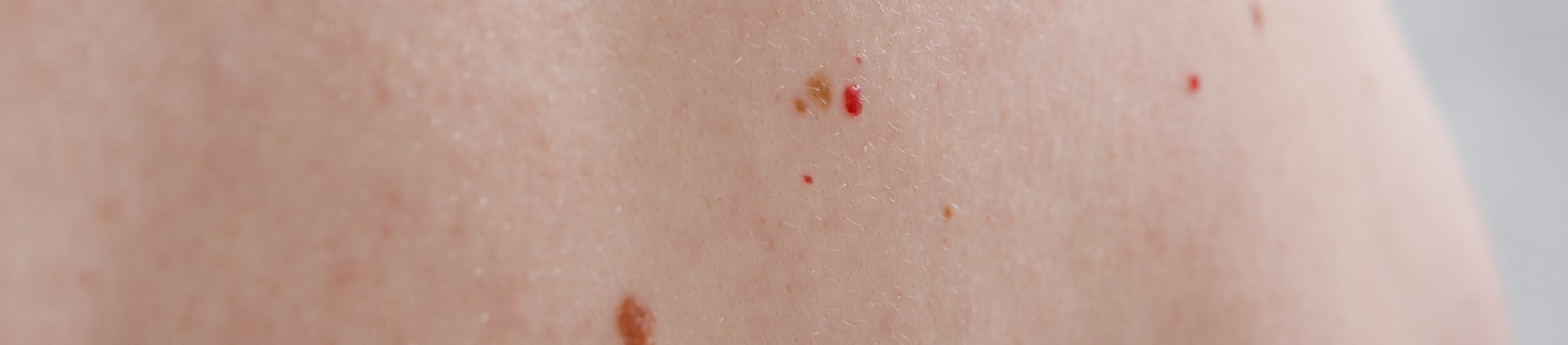 Nahaufnahme eines Rückens mit Rubinflecken