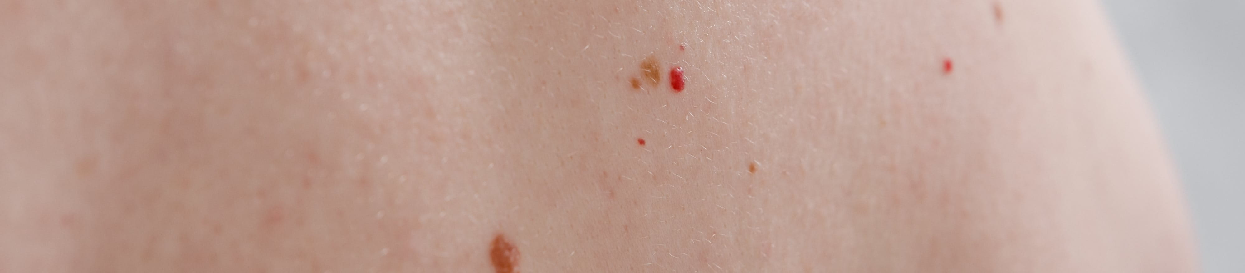 Nahaufnahme eines Rückens mit Rubinflecken