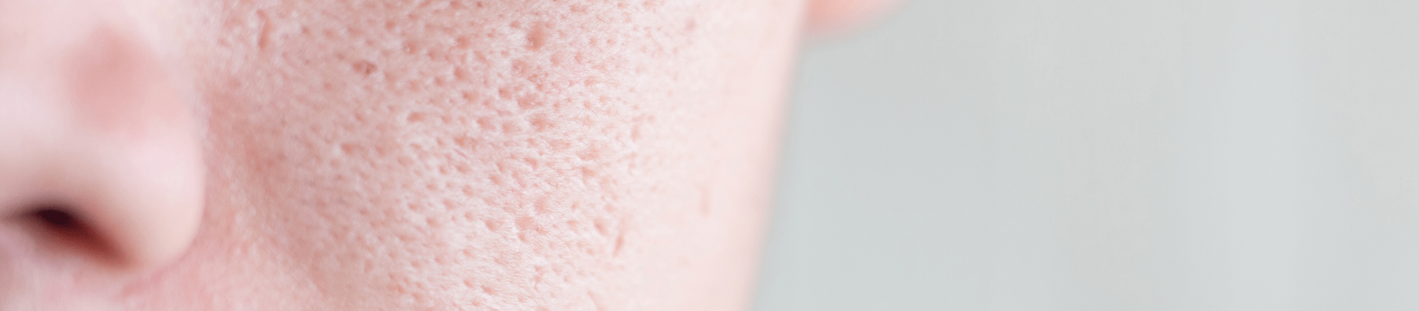 Nahaufnahme von einer Wange, auf der Poren deutlich sichtbar sind.