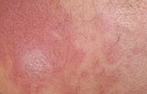 Eucerin Tutto Sulla Pelle Il Sole E La Pelle Scopri Come La Luce Del Sole Puo Influire Sulla Pelle