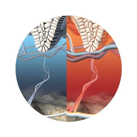 Darstellung der Temperaturregulation in der Haut