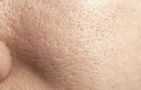 uvećana slika pora masne kože