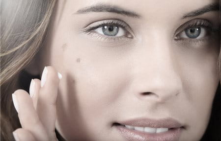Woman´s face with dark spots on cheek