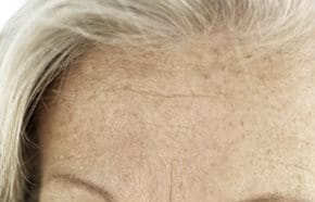 Age Spots Liver Spots Sun Spots Eucerin Age Spots Liver Spots Sun Spots Eucerin