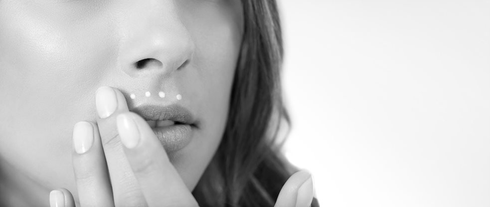 Rosto de mulher com melasma