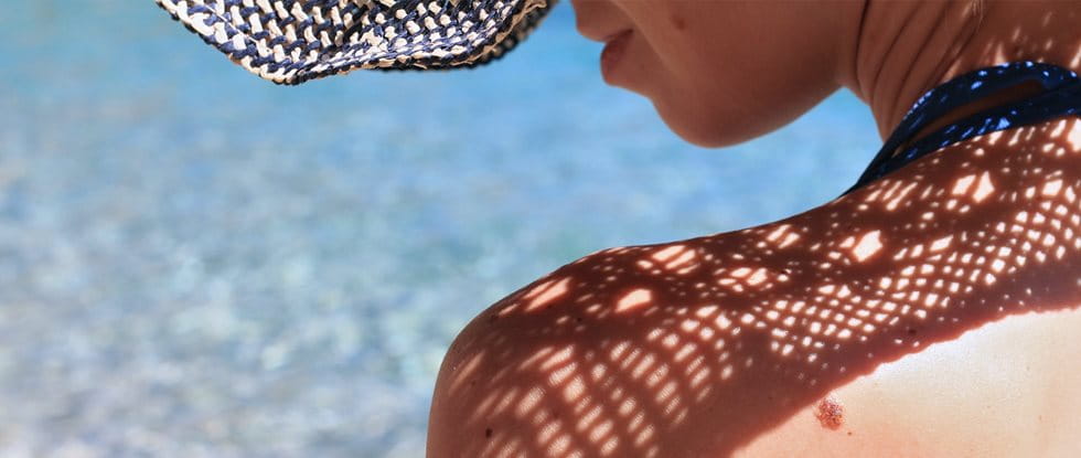 Sun sensitive skin and sun protection