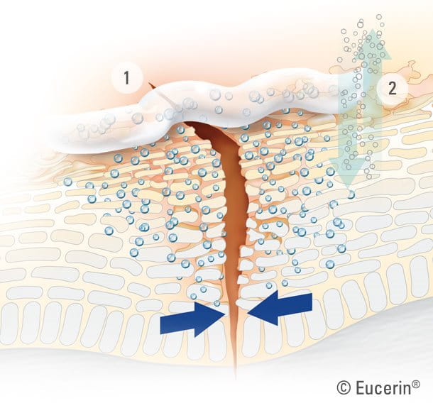 Aquaphor forma una barrire protettiva sulla pelle