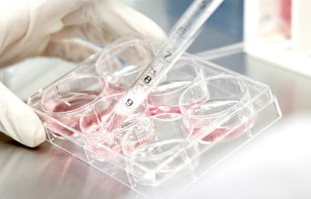 In-vitro test in laborytory