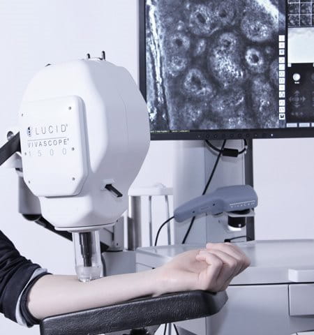 Female arm gets tested with CLMS (Confocal Laser Microscope)