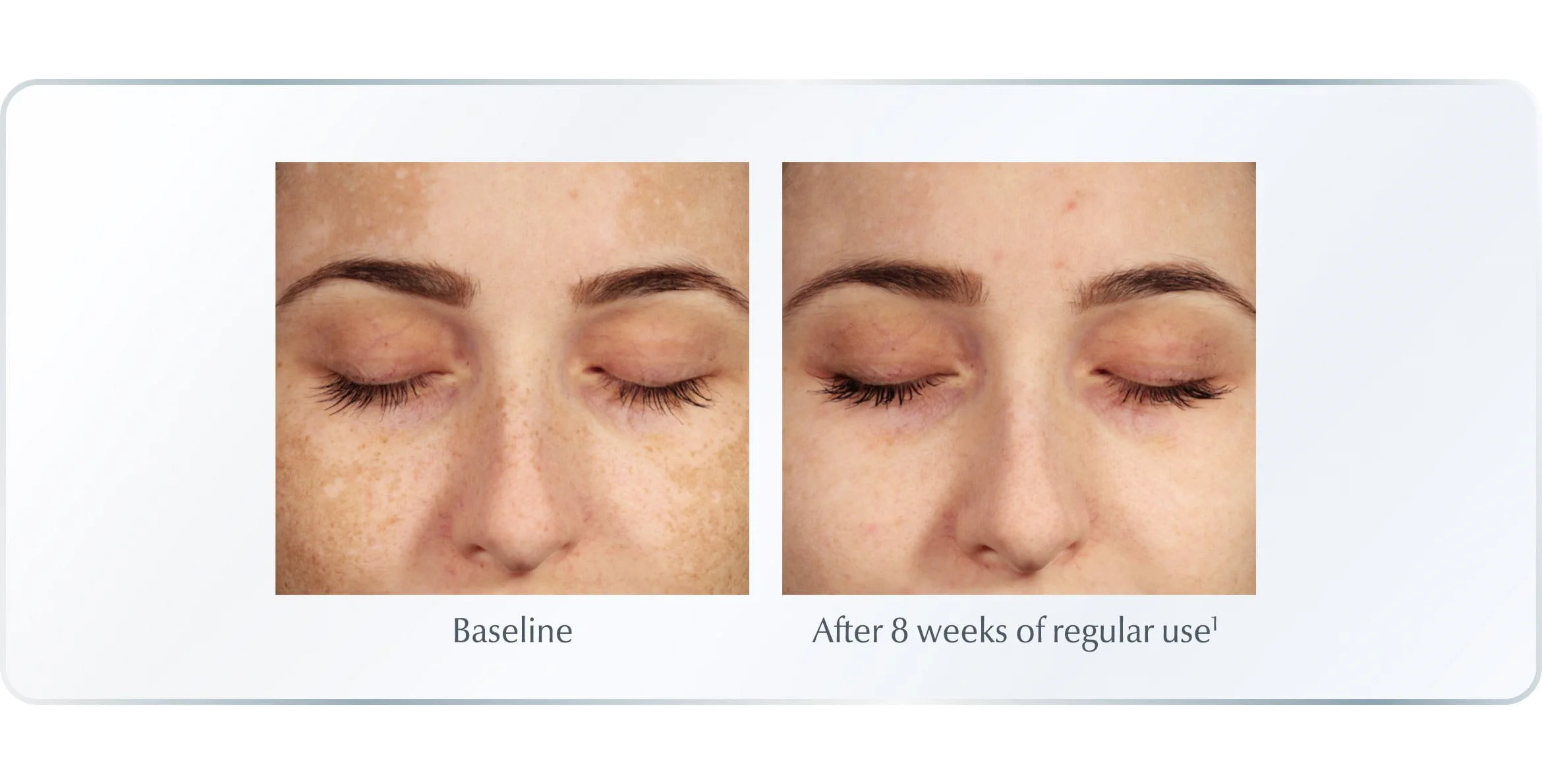 Even Pigment Perfector Dual Serum For All Skin Types Serum For Hyperpigmentation Eucerin