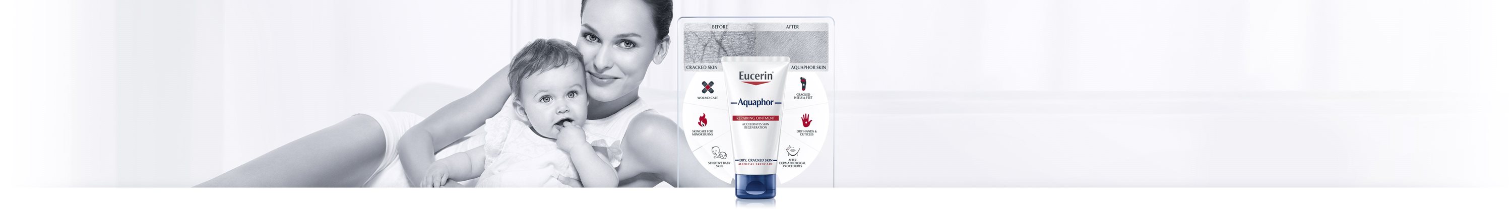 Aquaphor salv kahjustatud nahale