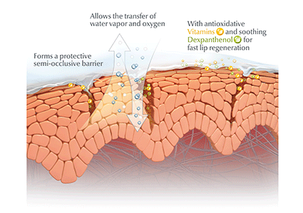 Hogyan működik az Eucerin száraz ajkakhoz kifejlesztett ajakbalzsama