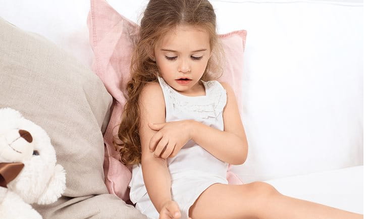 Zmírnění svědící pokožky